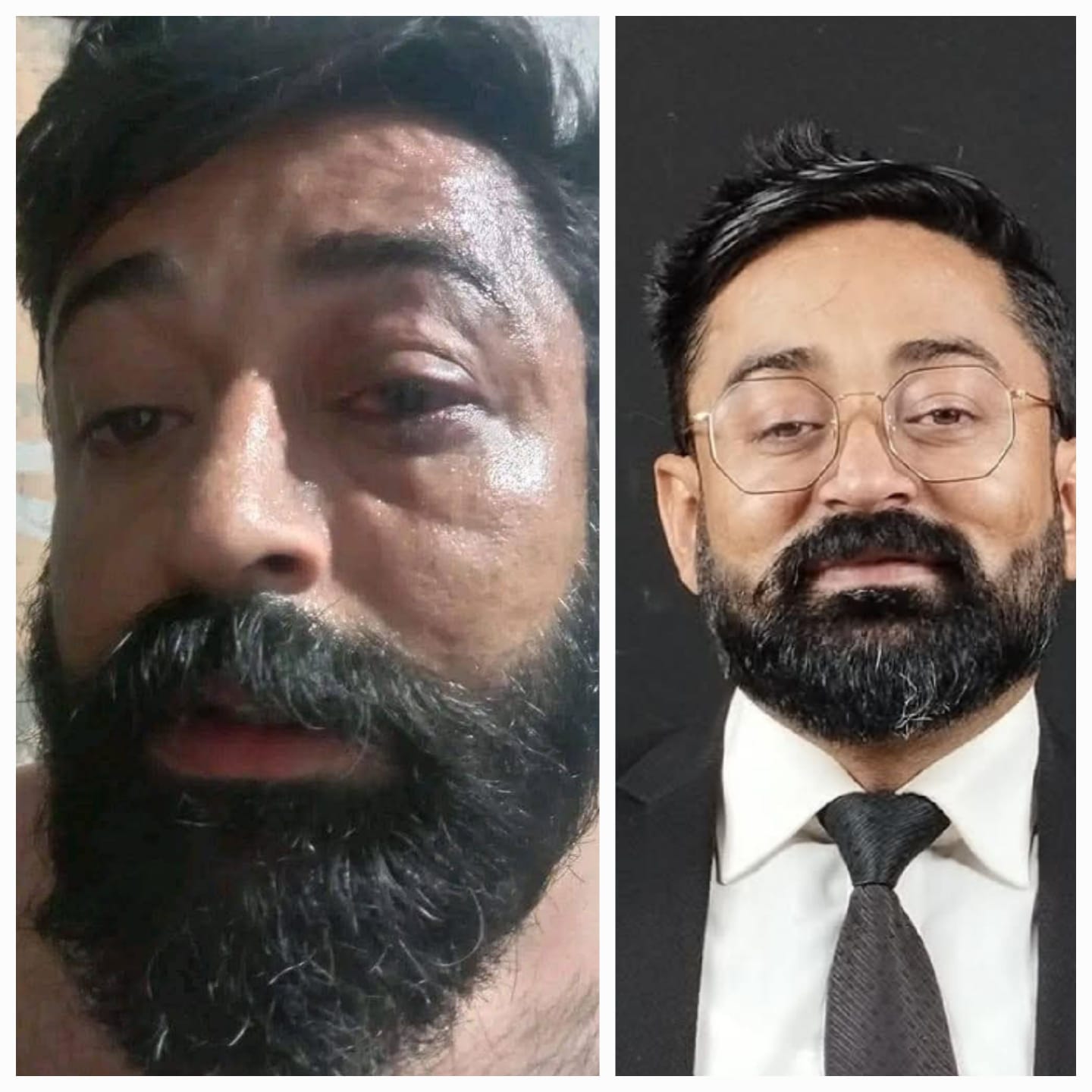 FIR Lodged Against SHO After Lawyers March To PS Mominabad Over Brutal 